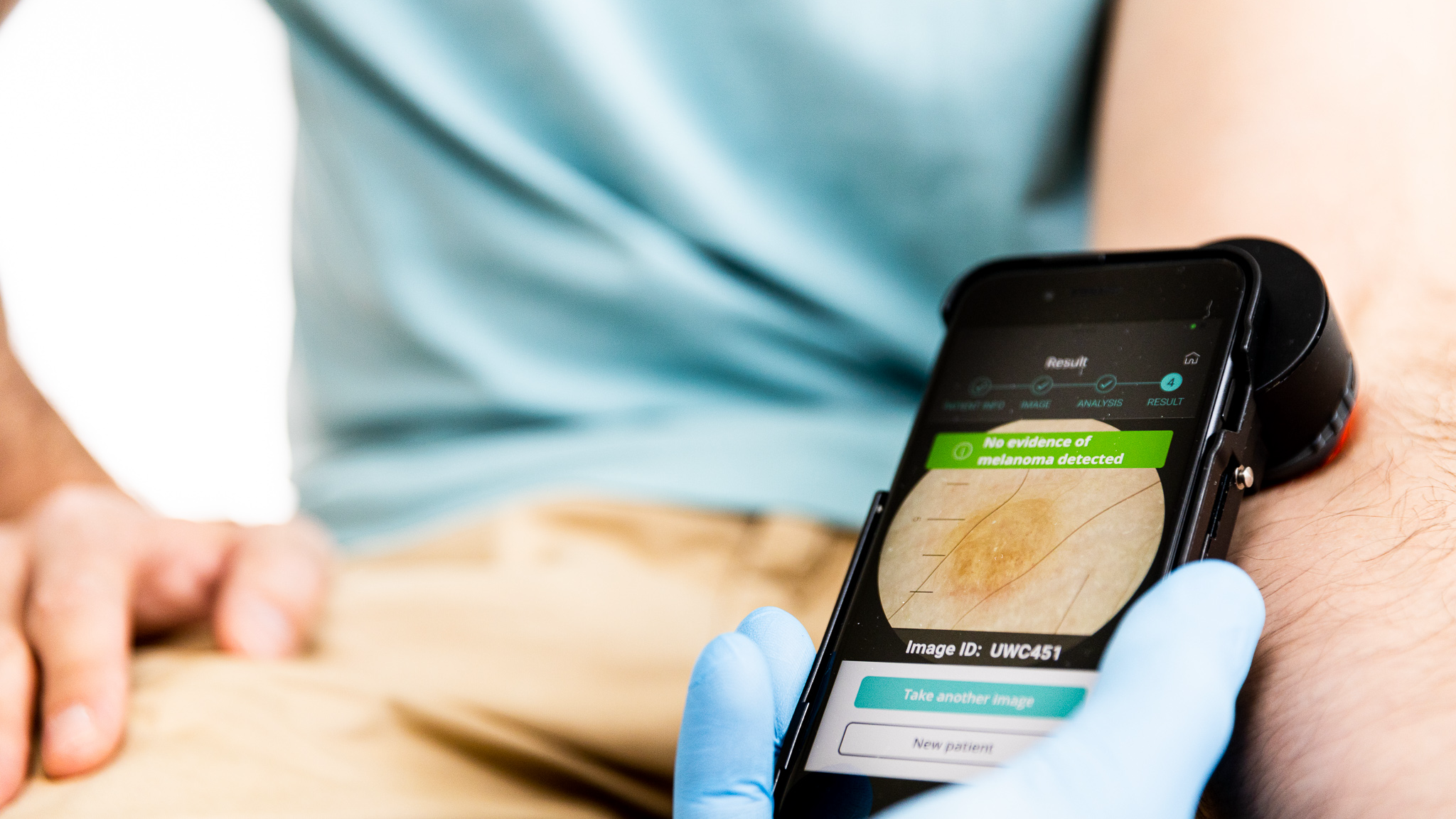 AI-powered melanoma app Dermalyser scores EU’s CE mark