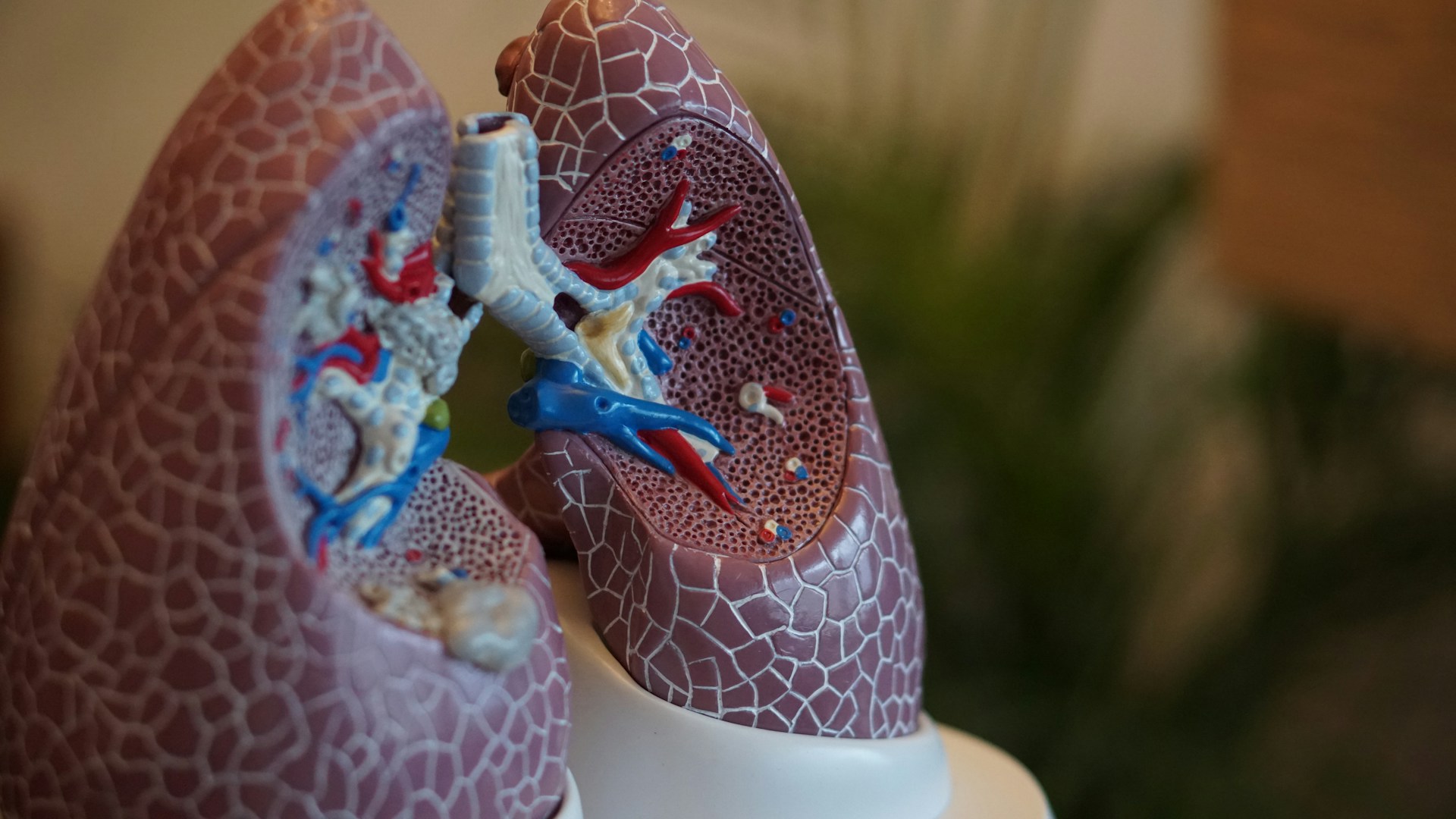 Chiesi collaborates with WPCC to enhance COPD detection