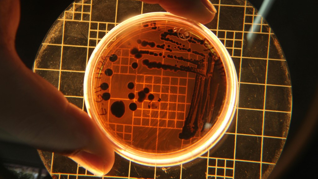pexels-wkandark-19728525-1024x576 BiomX’s phage therapy shows promise in tackling chronic infections in CF