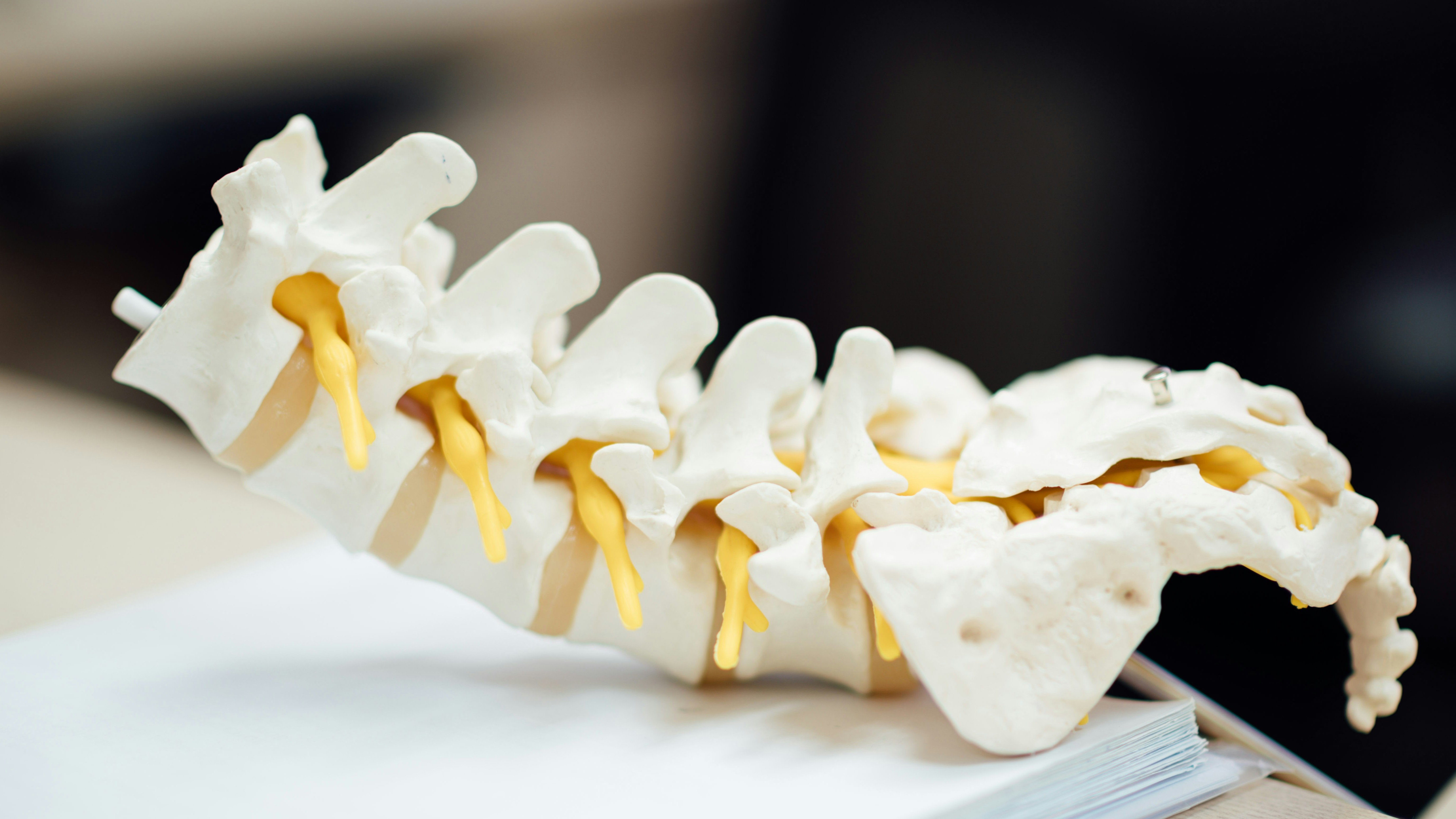Vivex Biologics completes enrollment in Phase II trial for back pain therapy