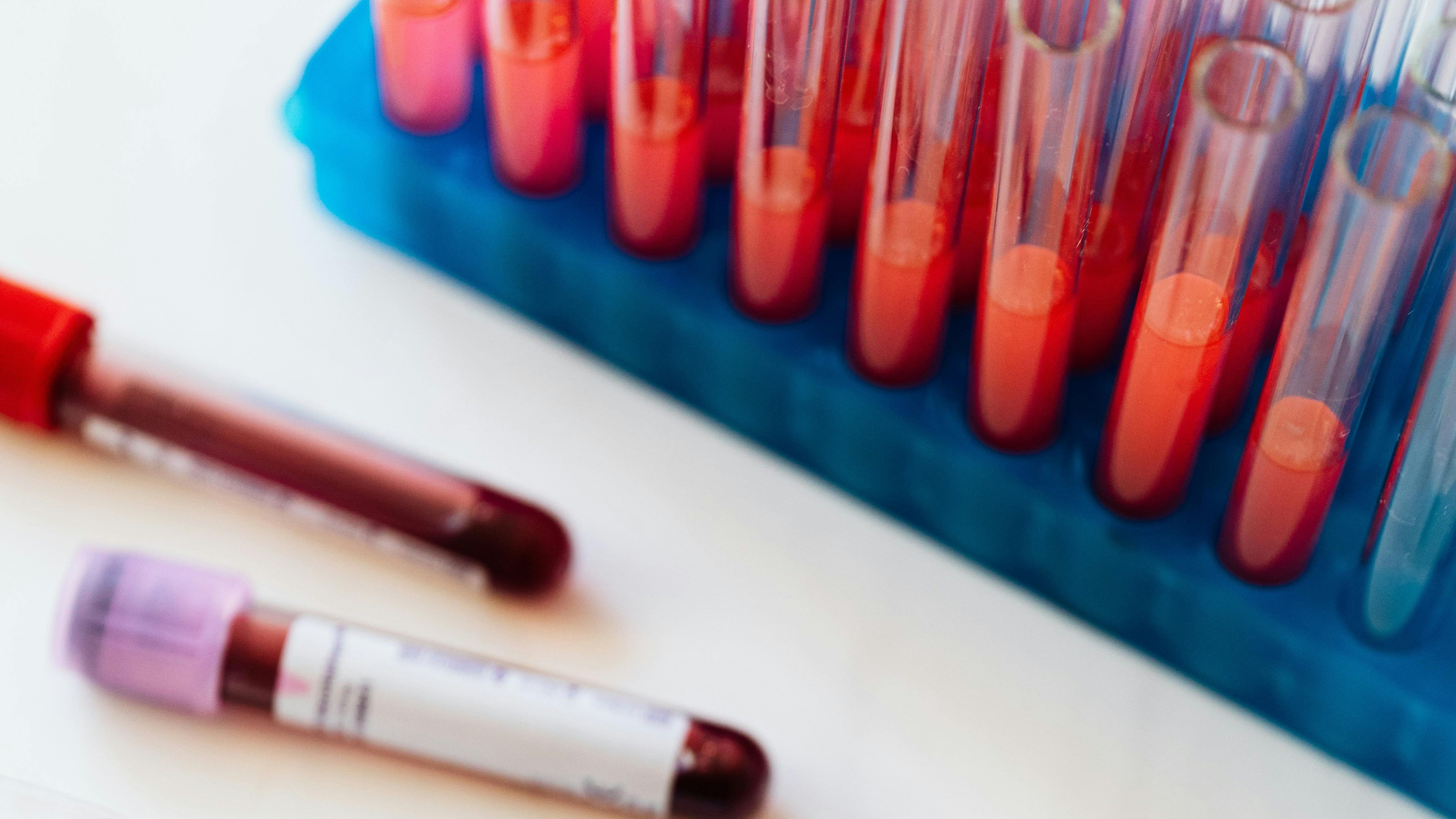 Daxor’s stock rises following FDA’s clearance for rapid blood volume analyzer