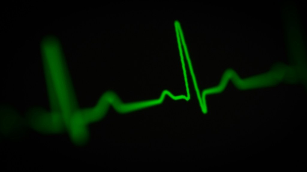joshua-chehov-oCSol-lBtVA-unsplash-1024x576 HeartBeam's stock shows strong pulse after FDA clearance