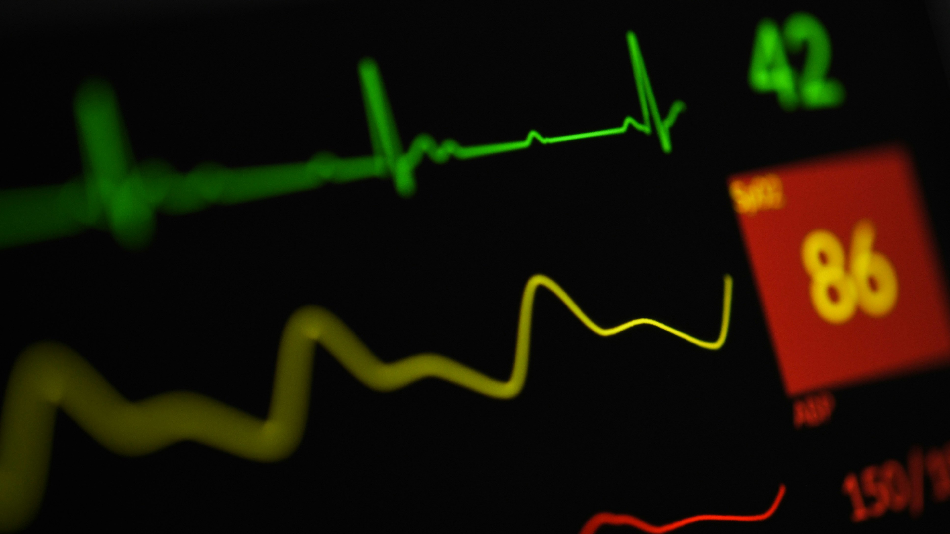 Beyond the Snapshot: Continuous physiologic monitoring in clinical trials